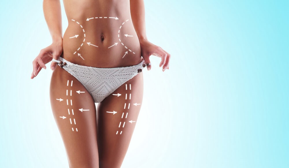 Best Cost of Liposuction Henderson, NV